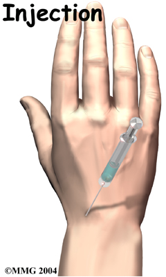 wrist_osteoarthritis_treatment01